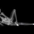 X-Ray Pin-Up Calendar