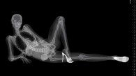 X-Ray Pin-Up Calendar